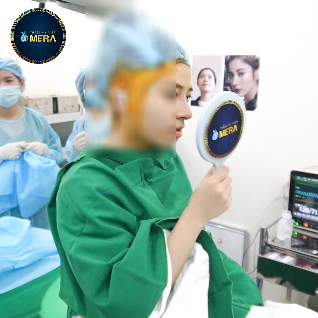 Nâng mũi an toàn với phương pháp cấu trúc tại TMV MERA - Ảnh 3.