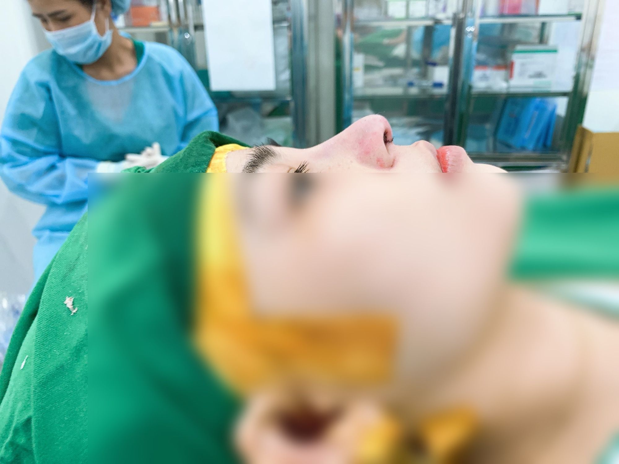 Nâng mũi an toàn với phương pháp cấu trúc tại TMV MERA - Ảnh 4.