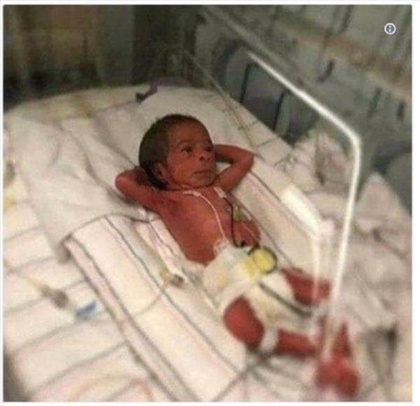 Hình ảnh em bé sơ sinh "lườm xắt xéo" bác sĩ khiến cư dân mạng được một trận cười thả ga - Ảnh 5.