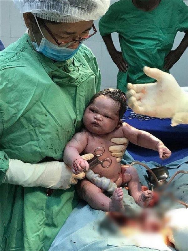 Hình ảnh em bé sơ sinh "lườm xắt xéo" bác sĩ khiến cư dân mạng được một trận cười thả ga - Ảnh 6.
