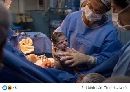 Hình ảnh em bé sơ sinh "lườm xắt xéo" bác sĩ khiến cư dân mạng được một trận cười thả ga - Ảnh 1.