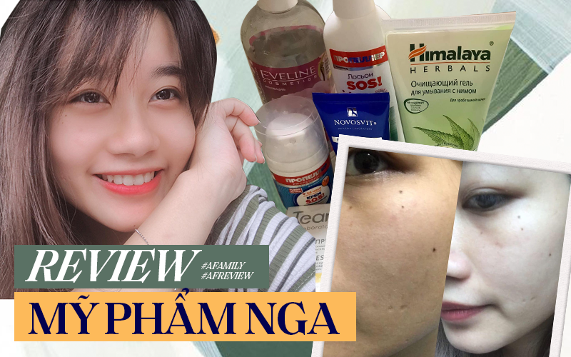 2 năm dùng đồ skincare của Nga, cô nàng này rút ra được 5 món ưng ý nhất cho làn da thiên dầu và nhiều thâm mụn 