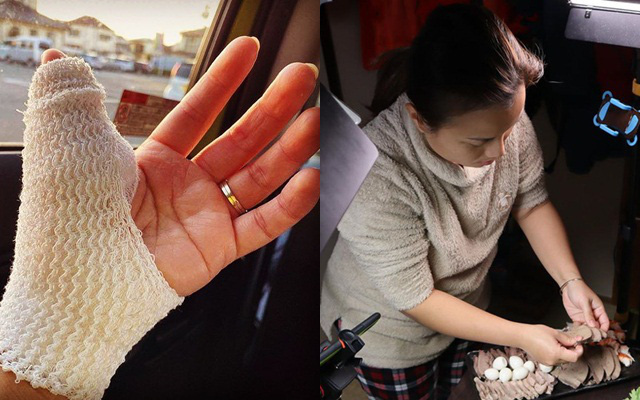 Dân mạng “thót tim” khi thấy bàn tay băng bó của Quỳnh Trần JP, nguyên nhân được hé lộ vì tai nạn nghề nghiệp khá nghiêm trọng