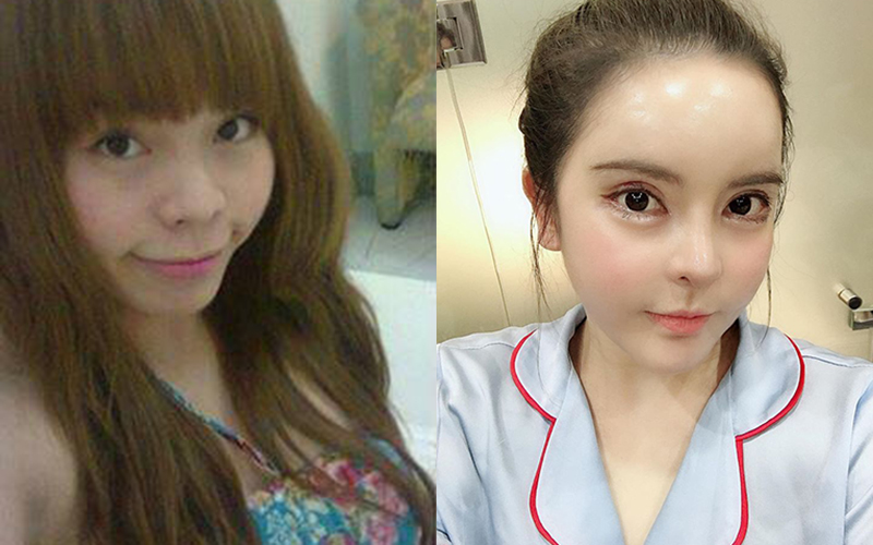 Mẹ Việt 2 con chi gần 1 tỷ đồng cho 8 cuộc phẫu thuật nâng cấp dung mạo, được báo Hàn đình đám Dispatch đưa lên trang nhất và gọi là &quot;nữ thần&quot;