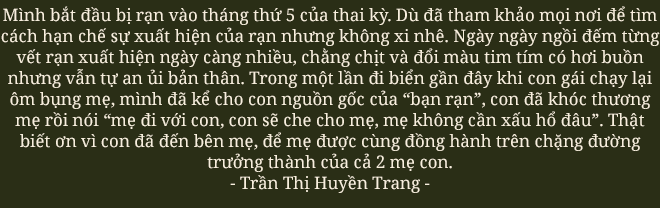  Vết nứt của đá trên bụng mẹ: Nỗi đau xé toạc thanh xuân nhưng là dấu ấn tuyệt đẹp của hành trình trưởng thành - Ảnh 24.