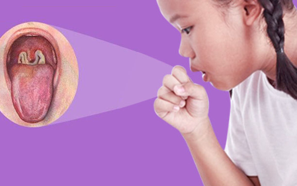 2 bé ở Đắk Nông mắc bệnh bạch hầu: Những điều cần biết về bệnh nhiễm trùng dễ dàng qua đường hô hấp này để phòng bệnh tốt nhất