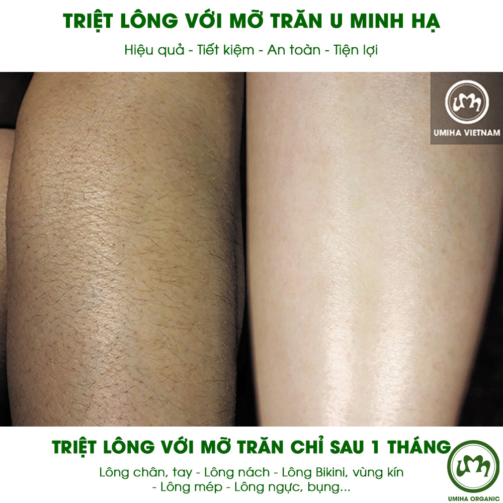 Đừng để cơn ác mộng mang tên “lông lá rậm rạp” phá huỷ mùa hè trong mơ của bạn - Ảnh 3.