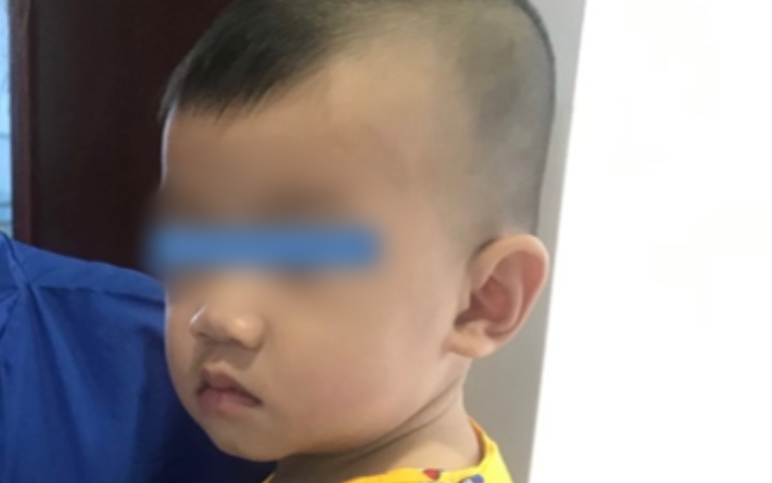 Tai nạn kinh hoàng: Mẹ đi pha sữa, bé trai 10 tháng tuổi bò xuống gầm bàn nuốt mảnh gương vỡ vào bụng