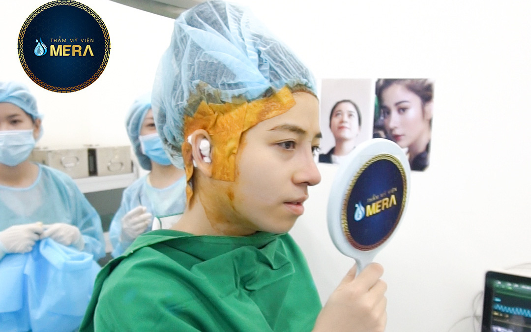 Đẹp hơn với dáng mũi tại Thẩm mỹ viện Mera