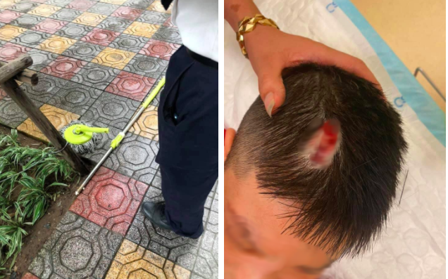 Hà Nội: Chổi lau nhà rơi từ tầng 5 chung cư cao cấp khiến bé trai vỡ đầu phải nhập viện