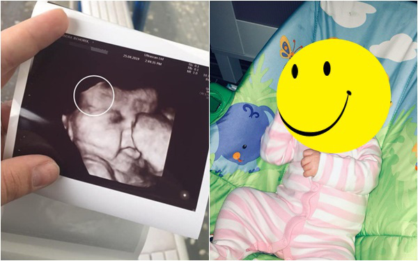 Siêu âm bác sĩ nhìn thấy thai nhi có 1 điểm đặc biệt, vừa chào đời em bé đã lập tức nổi tiếng cả bệnh viện