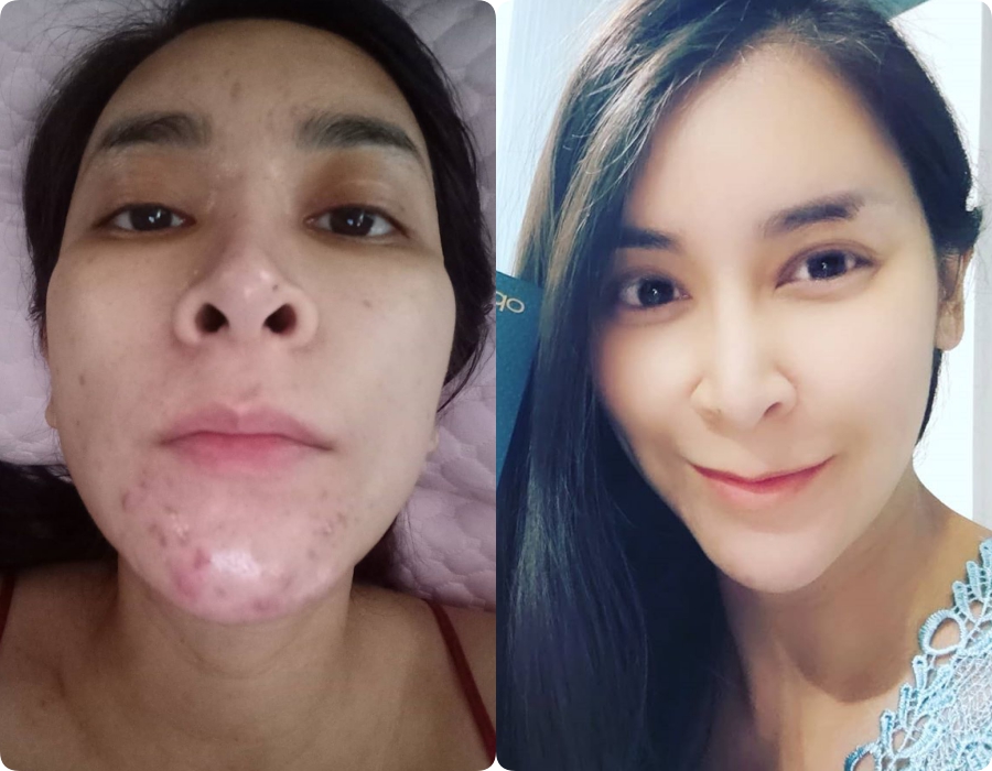 Chẳng phải Vit C hay Retinol, đây mới là thành phần mà mọi bác sĩ da liễu đều khuyên chị em nên dùng để có làn da sáng mịn như gái đôi mươi - Ảnh 3.