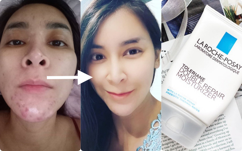 Chẳng phải Vit C hay Retinol, đây mới là thành phần mà mọi bác sĩ da liễu đều khuyên chị em nên dùng để có làn da sáng mịn như gái đôi mươi