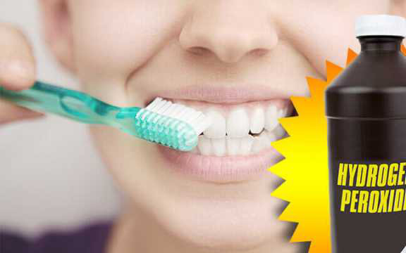 Dùng hydrogen peroxide để làm trắng răng như hướng dẫn trên TikTok: Chuyên gia khuyến cáo cần hết sức cẩn trọng!