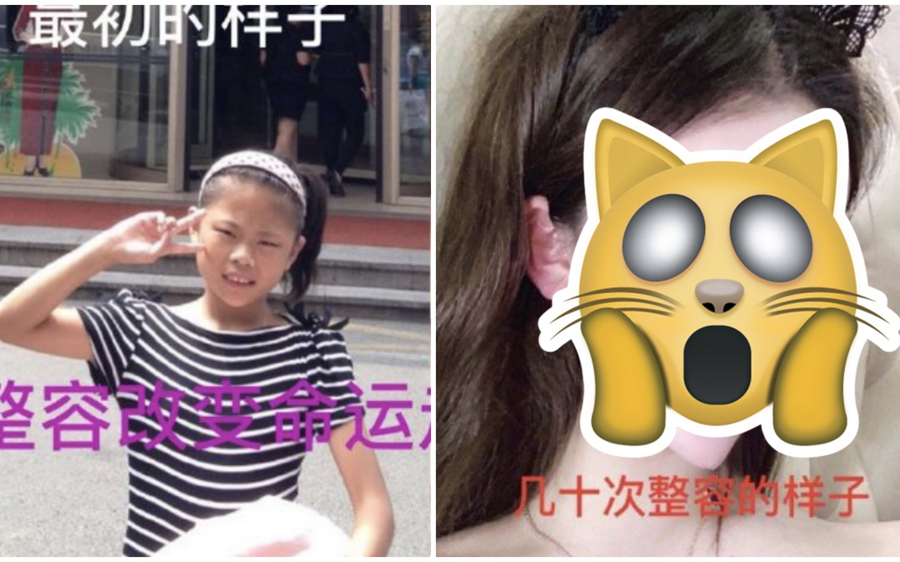 Nghiện dao kéo từ năm 13 tuổi, gương mặt sau hơn 100 lần phẫu thuật thẩm mỹ của hot girl xứ Trung khiến ai nhìn cũng sửng sốt
