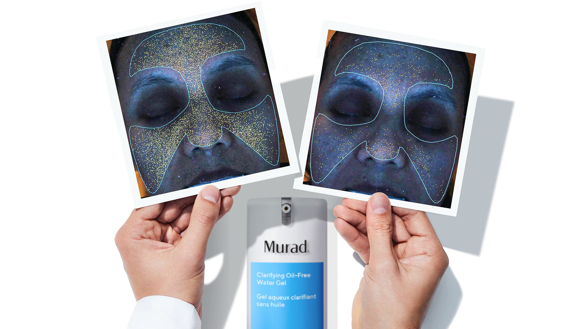 Review gel ngừa mụn tối ưu cho da dầu của Murad