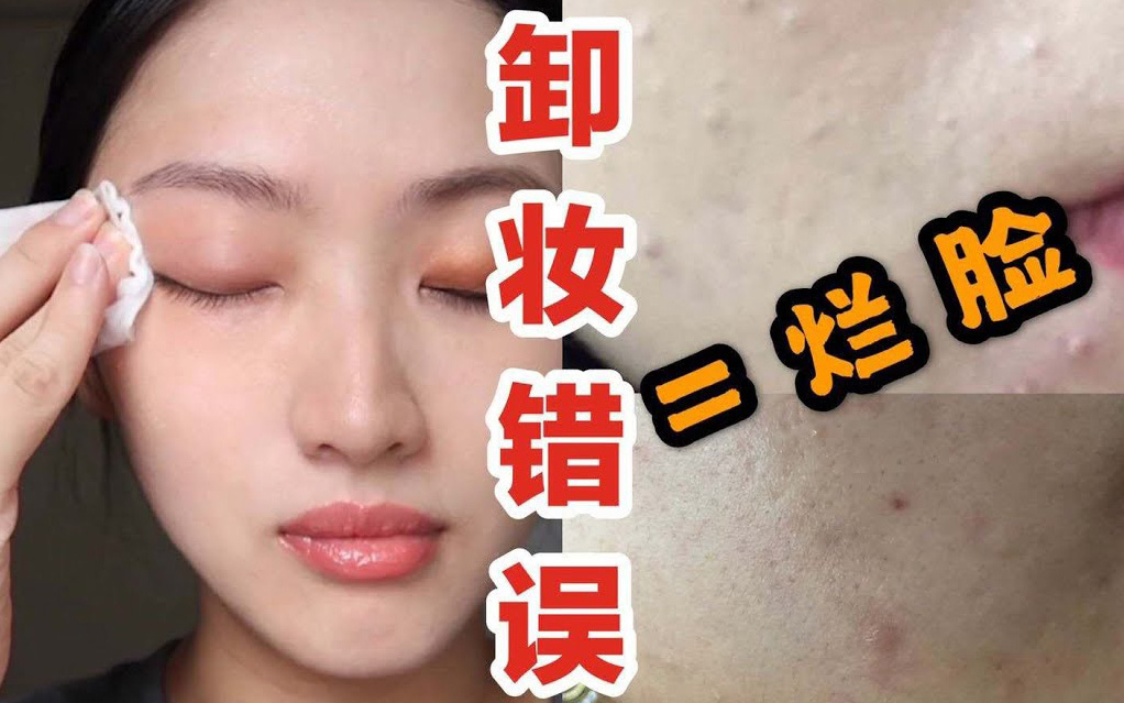 Beauty blogger người Nhật cảnh báo: Chị em đang "hủy hoại" chính làn da của mình ngay từ bước tẩy trang
