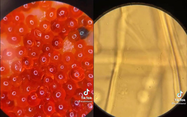Xem clip soi trứng cá hồi sống dưới kính hiển vi, thứ hiện ra khiến ai nấy đều bất ngờ 