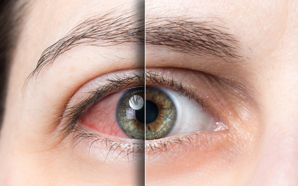 10 phương pháp bảo vệ mắt mà nhân viên văn phòng cần biết