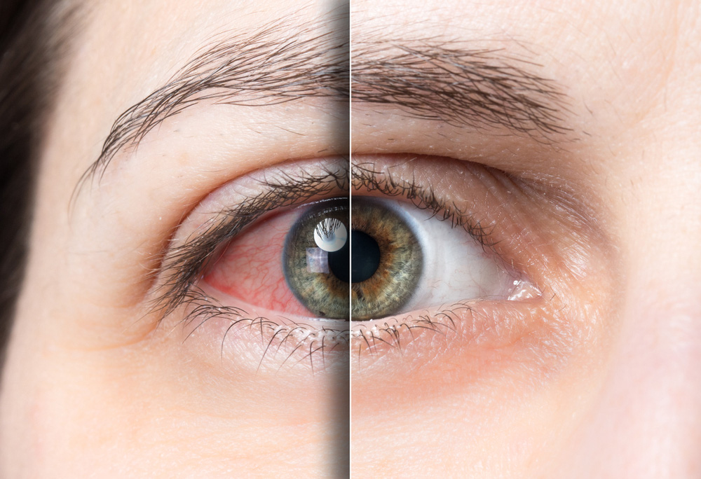 10 phương pháp bảo vệ mắt mà nhân viên văn phòng cần biết - Ảnh 1.