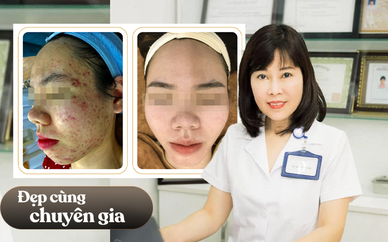 Bác sĩ da liễu cảnh báo: Phụ nữ Việt thường rất hay mắc sai lầm này khi chăm da nhưng vẫn “tặc lưỡi cho qua”