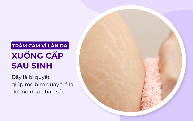 Trầm cảm vì làn da xuống cấp sau sinh: Đây là bí quyết giúp mẹ bỉm quay trở lại đường đua nhan sắc - Ảnh 1.