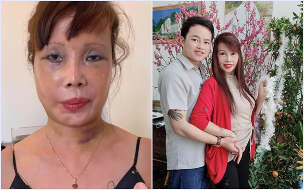 Vừa khoe gương mặt đã khỏi bị lệch, cô dâu Cao Bằng 64 tuổi lại hé lộ hình ảnh cho thấy mối quan hệ của chồng &quot;phi công&quot; với con gái riêng của vợ