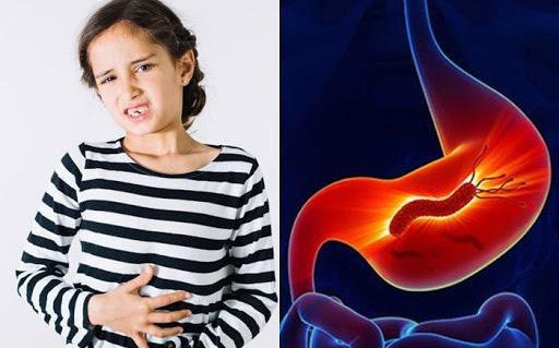Những điều cha mẹ cần lưu ý khi dùng kháng sinh điều trị HP dạ dày ở trẻ nhỏ