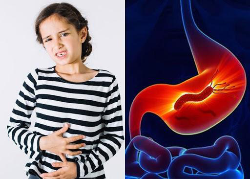 Những điều cha mẹ cần lưu ý khi dùng kháng sinh điều trị HP dạ dày ở trẻ nhỏ - Ảnh 1.