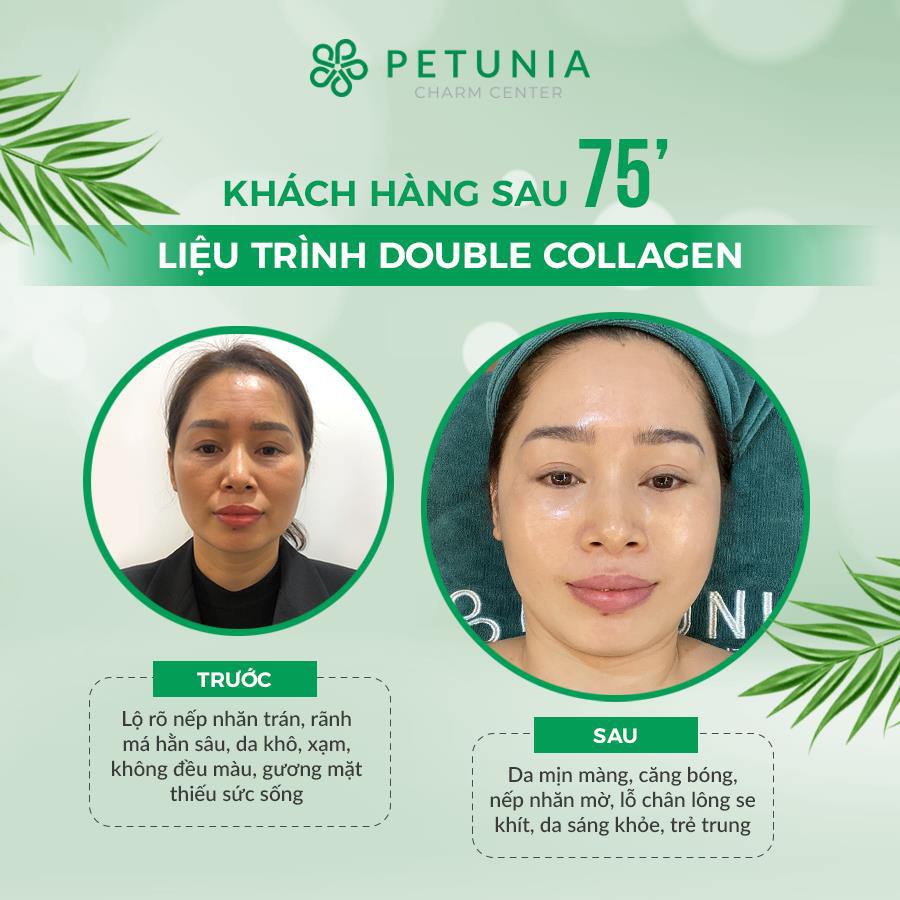 Đột phá trong ngăn ngừa lão hóa, giảm nhăn không xâm lấn bằng công nghệ Double Collagen - Ảnh 5.