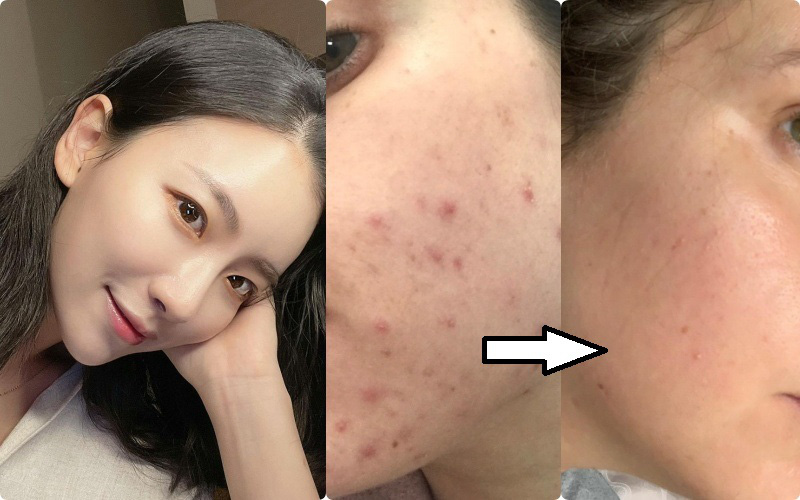 Sự đầu tư khôn ngoan nhất của nàng ngoài 30 là một lọ serum &quot;xử lý&quot; nhanh gọn nếp nhăn, thâm nám để trở về làn da căng mướt của tuổi 20