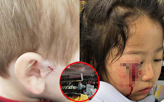 Bé trai 4 tuổi bị thương nặng ở tai vì thứ bé xíu trong siêu thị, cửa hàng quần áo nào cũng có