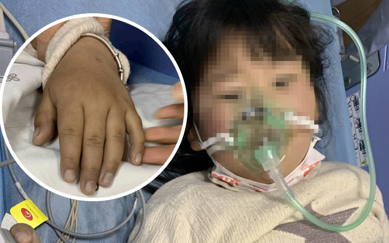 Bé gái 5 tuổi bị ngộ độc do ăn kim chi tự làm, cảnh báo bố mẹ những thực phẩm không nên cho trẻ ăn