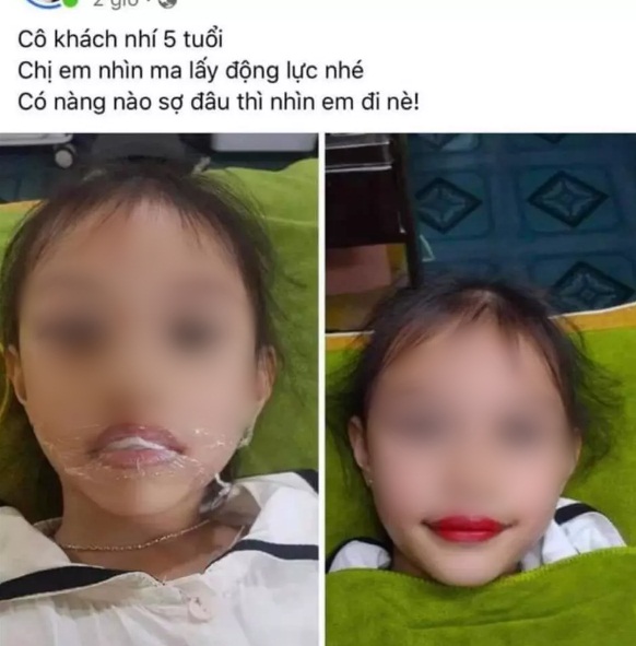 Xôn xao hình ảnh bé gái 5 tuổi đã được phụ huynh cho đi xăm môi, cư dân mạng lập tức nổ ra bình luận trái chiều - Ảnh 1.