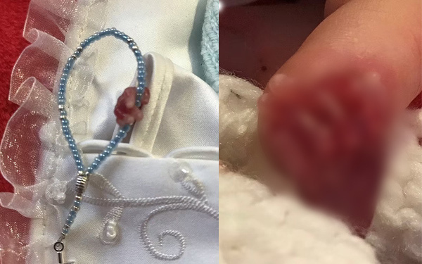 Uống thuốc phá thai lúc bầu 18 tuần, mẹ bất ngờ khi thai vẫn còn sống, nhìn con chào đời mà tột cùng hối hận