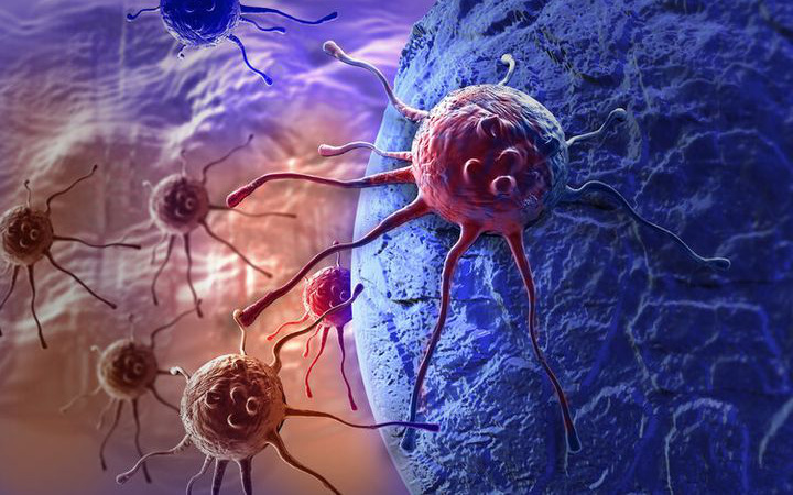 Ai cũng có "tế bào ung thư", chuyên gia kiến nghị 4 bộ mật mã chống ung thư, lợi ích cả đời