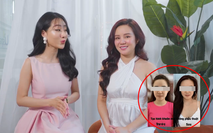 Vy Oanh bị "đào mộ" clip chỉnh sửa toàn bộ gương mặt tại thẩm mỹ viện