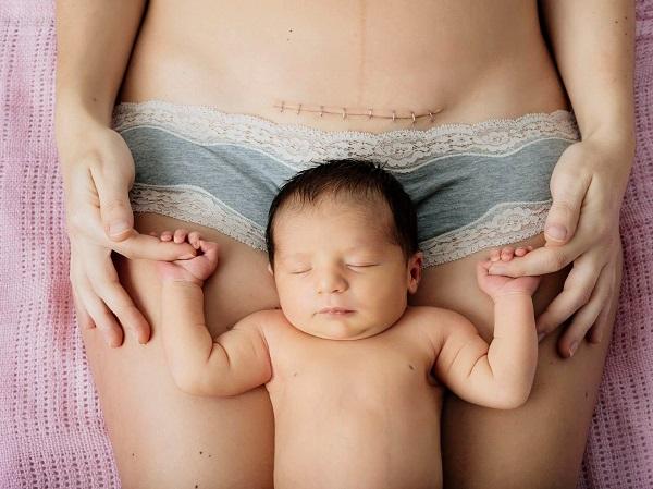 "Thả" nhiều năm vẫn không có con, bác sĩ làm ngay điều này, chưa đầy 2 tháng sau bệnh nhân khoe 2 vạch! - Ảnh 15.