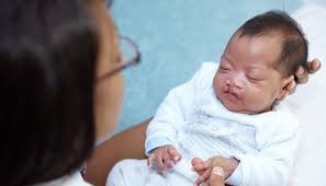 Phẫu thuật sứt môi, hở hàm ếch: Từ lưu ý đến giá cả, nơi nên thực hiện được chuyên gia chia sẻ tường tận - Ảnh 10.