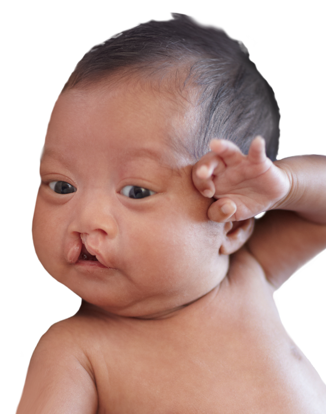 Phẫu thuật sứt môi, hở hàm ếch: Từ lưu ý đến giá cả, nơi nên thực hiện được chuyên gia chia sẻ tường tận - Ảnh 14.