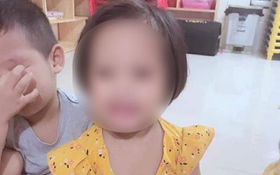 Bé 3 tuổi nghi bị bạo hành ở Hà Nội với 9 chiếc đinh găm vào sọ: Cần khởi tố vụ án để điều tra làm rõ