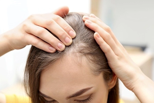 5 Cách chữa trị rụng tóc dân gian hiệu quả nhất tại nhà  Rungtocvn