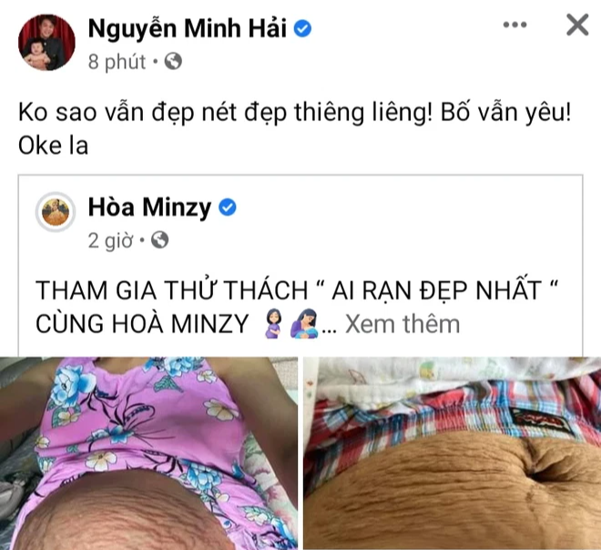 Hoà Minzy đăng ảnh bụng chi chít vết rạn sau sinh, chồng thiếu gia xúc động: Không sao, vẫn đẹp, bố vẫn yêu - Ảnh 2.