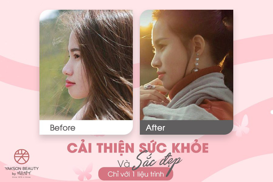 Golki và câu trả lời từ chuyên gia Hàn Quốc - Ảnh 2.