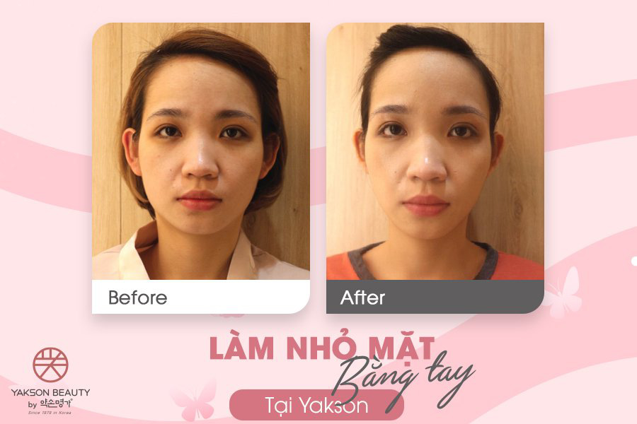 Golki và câu trả lời từ chuyên gia Hàn Quốc - Ảnh 3.