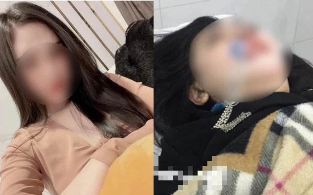 Vụ mẹ đơn thân 22 tuổi tử vong sau nâng mũi ở Hà Nội: Người cho mượn địa điểm làm phẫu thuật liên đới thế nào?