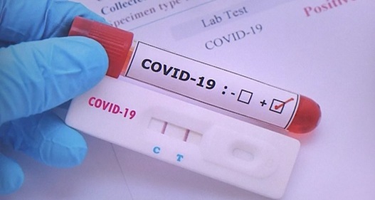 Tái nhiễm Covid-19, nhiều người nhanh trí làm ngay điều này để nhanh khỏi khiến bác sĩ 
