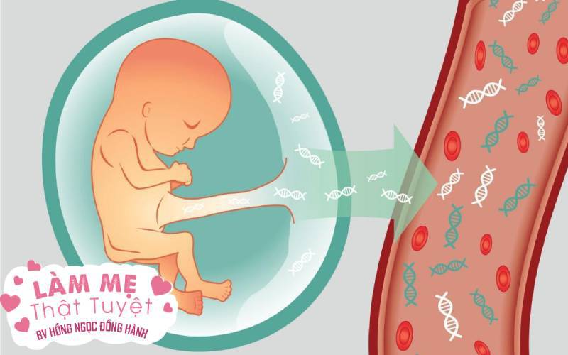 Để biết con có mắc hội chứng Down không, mẹ có thể làm những việc này