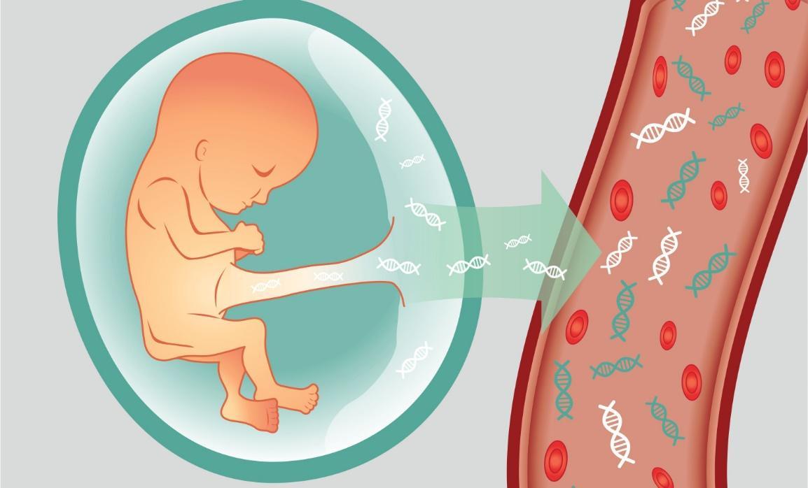 Để biết con có mắc hội chứng Down không, mẹ có thể làm những việc này - Ảnh 3.