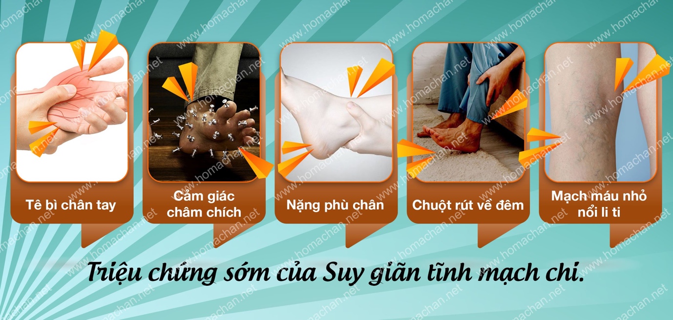 TPBVSK Hộ Mạch An - Giải pháp hỗ trợ người bị suy giãn tĩnh mạch - Ảnh 2.